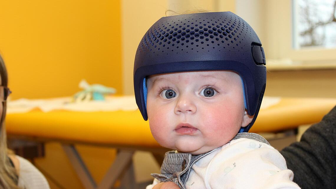 Säugling mit Helm aus dem 3D-Drucker von Talee zur Kopfkorrektur