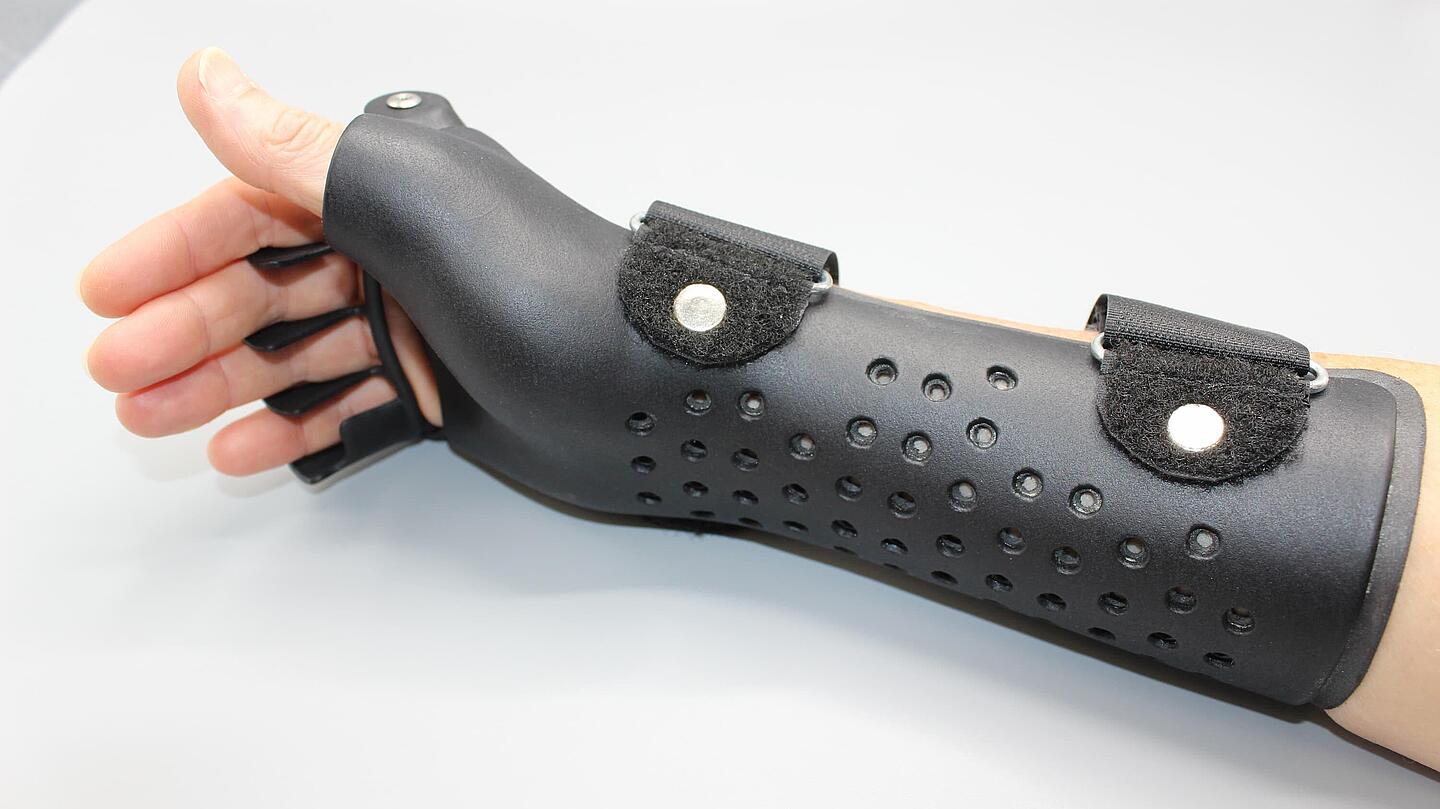 schwarze Ulnardeviationsorthesen aus dem 3D-Drucker