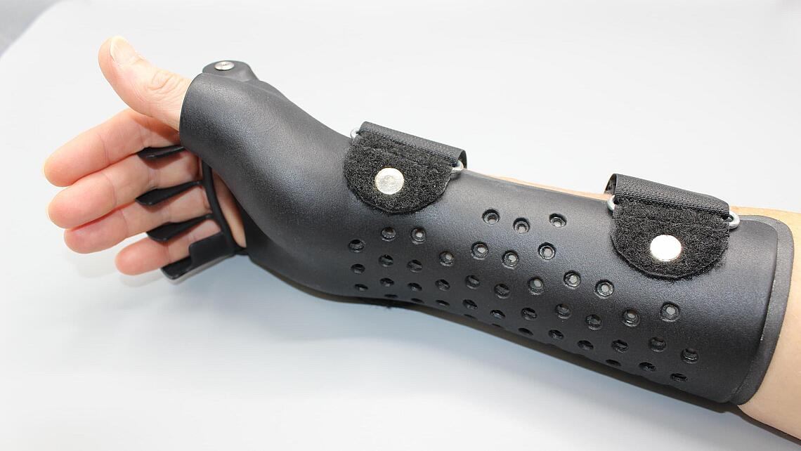 schwarze Ulnardeviationsorthesen aus dem 3D-Drucker