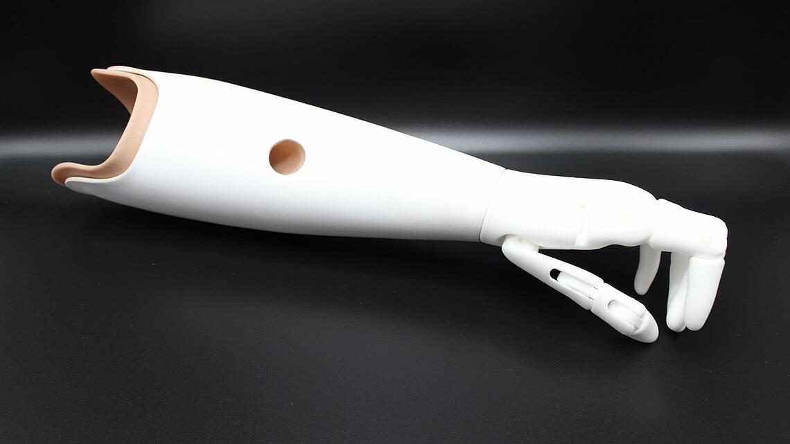 weiße, passive Unterarmprothese aus dem 3D-Drucker ohne kosmetischen Überzug