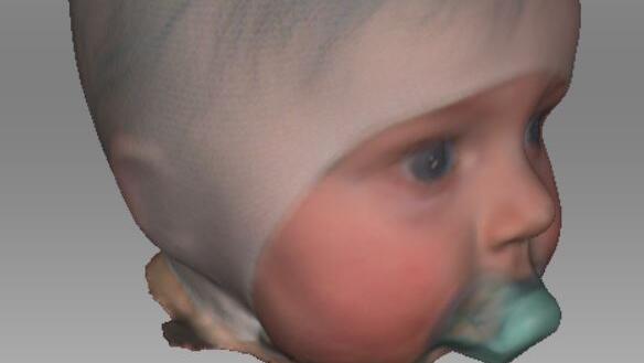 Kopf-Scans in 3D eines Säuglings