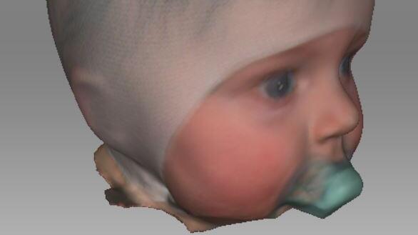 Kopf-Scans in 3D eines Säuglings