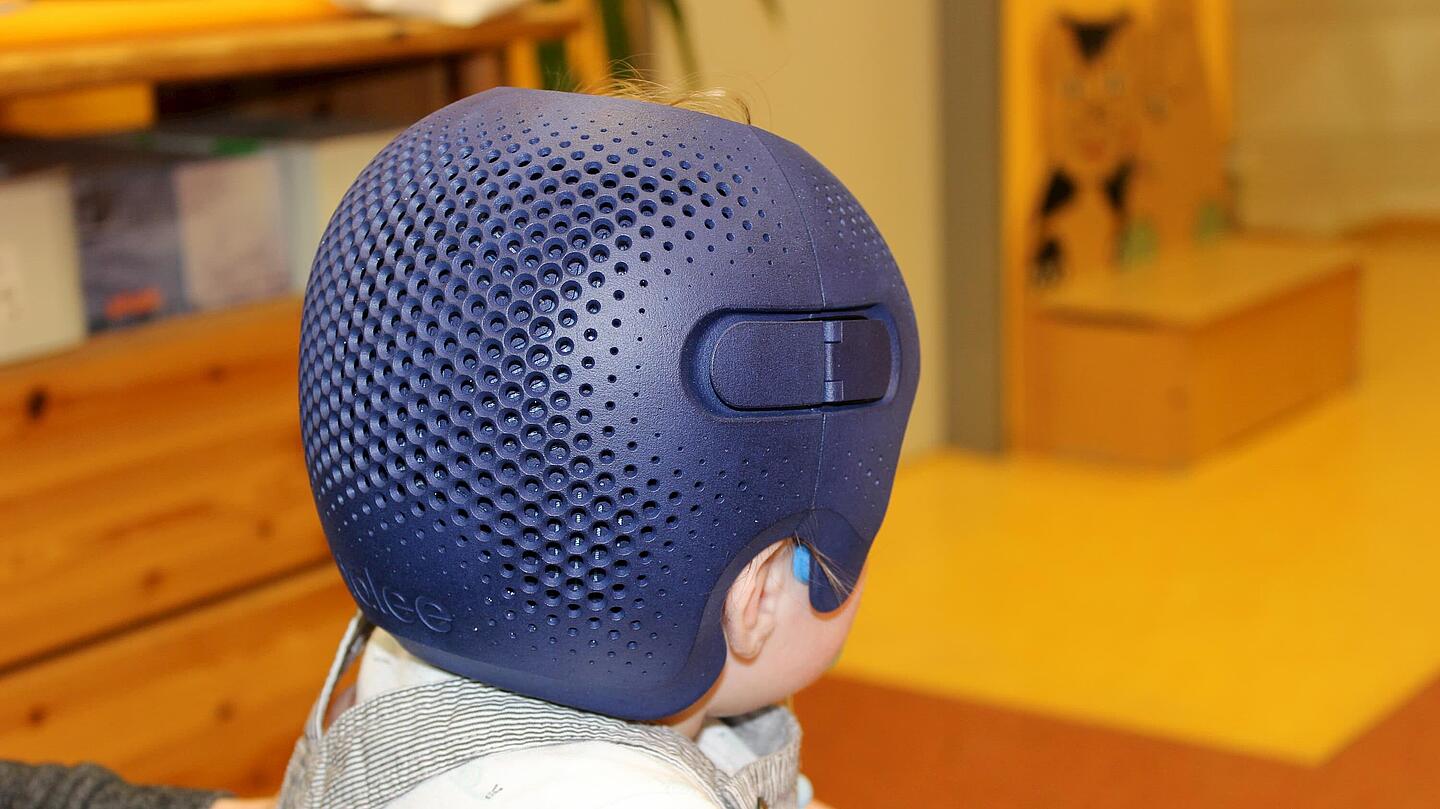 Säugling von hinten mit Helm aus dem 3D-Drucker von Talee zur Kopfkorrektur