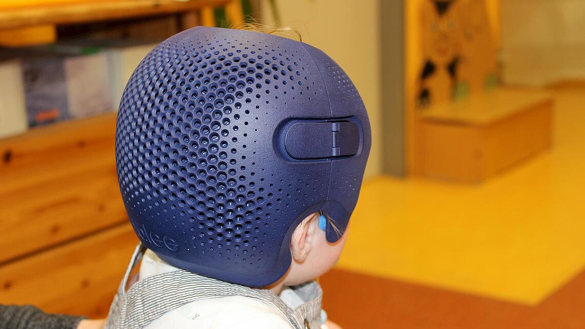 Säugling von hinten mit Helm aus dem 3D-Drucker von Talee zur Kopfkorrektur