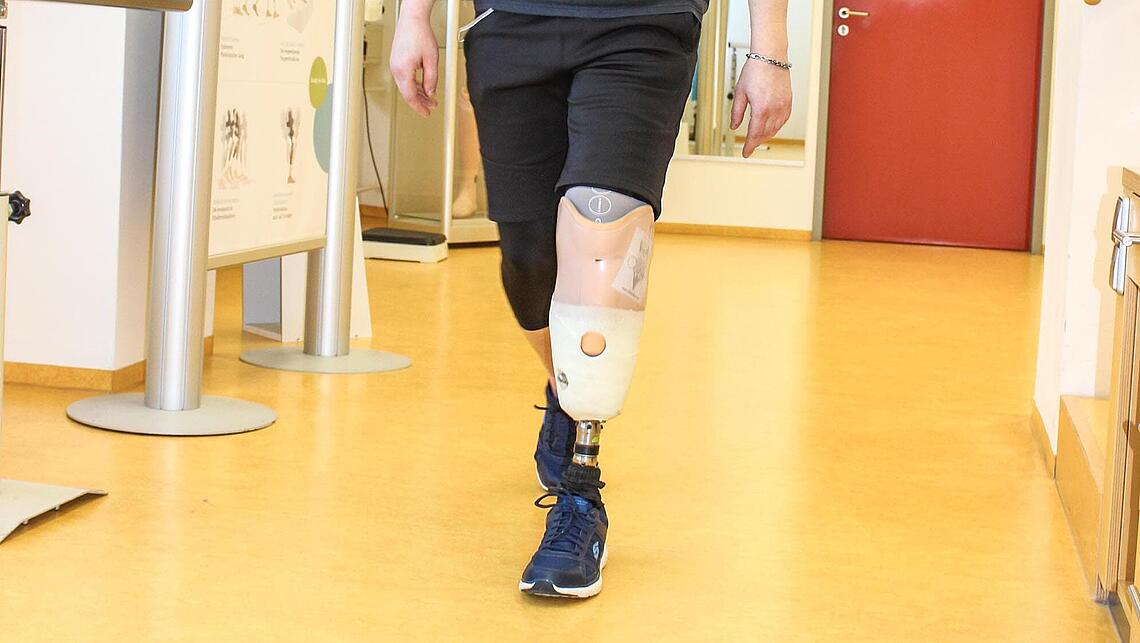 Mann läuft mit Beinprothese bei Prothesen-Gebrauchsschulung