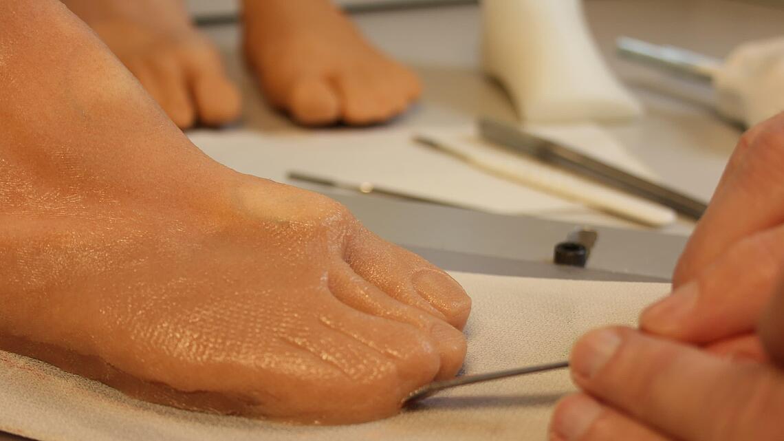 Modellierung einer Fußprothese mit Spatel