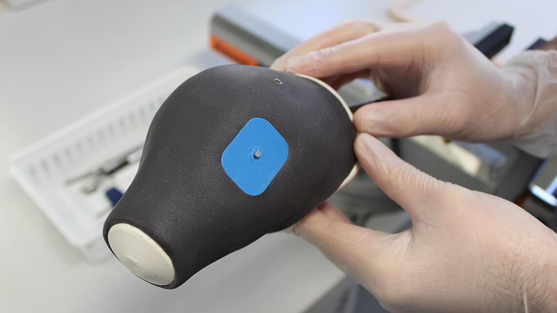 schwarz-blauer Silikon-Schaft für eine Unterarmprothese