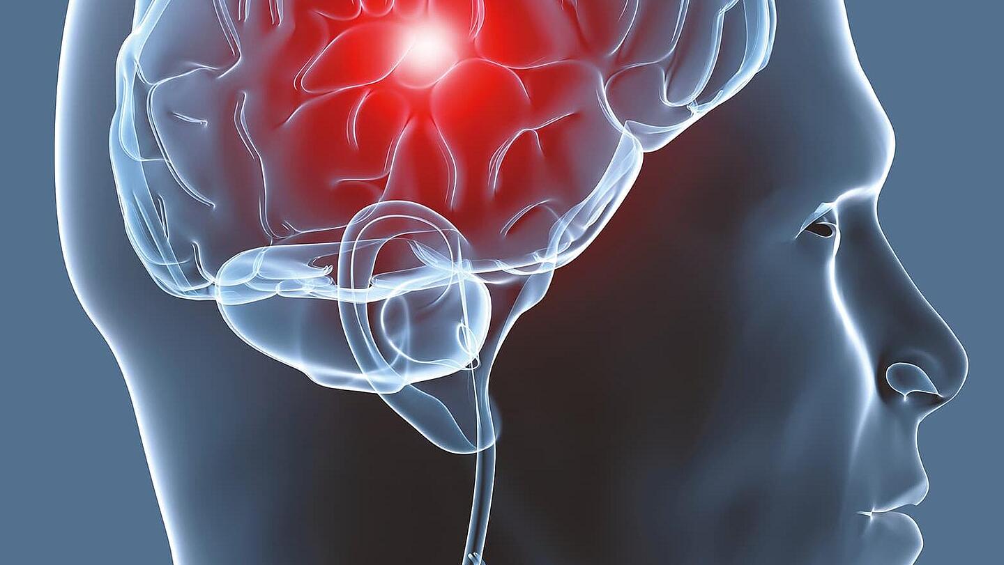 Schemabild von einem Kopf mit Gehirn, in dem ein rot leuchtender Punkt zu sehen ist, Bild: Ottobock