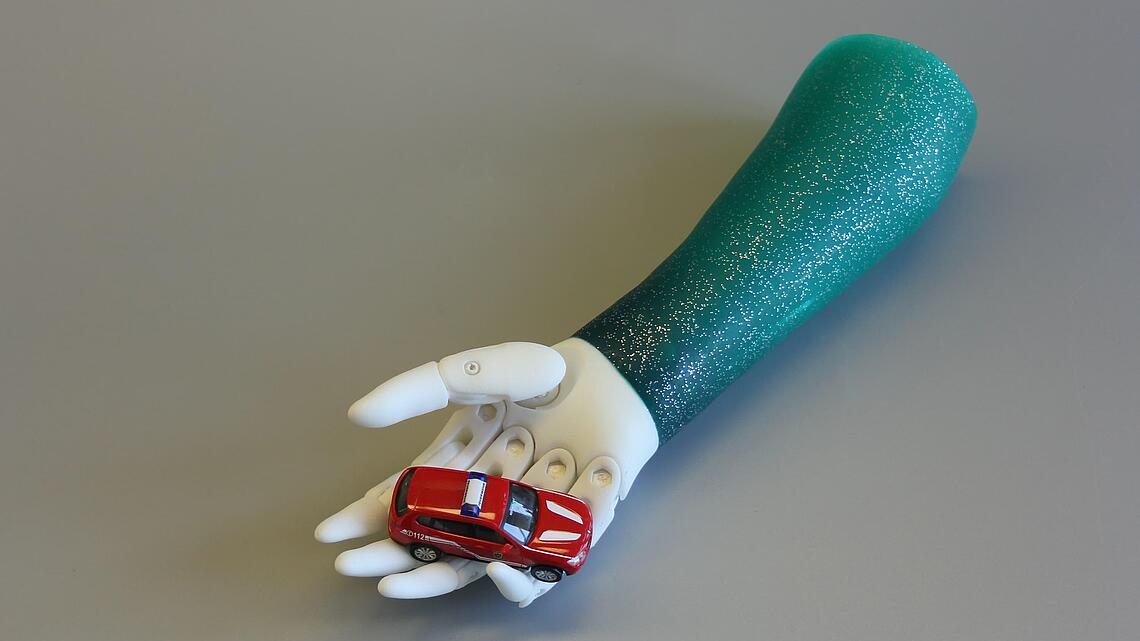 Unterarmprothese mit türkisem Glitzer-Silikon-Schaft, der ein kleines Auto hält