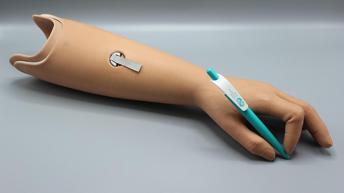 passive Unterarmprothese aus dem 3D-Drucker mit kosmetischen Überzug