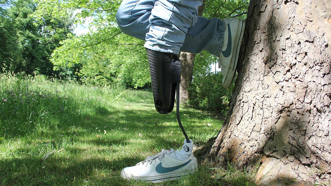 Träger einer Unterschenkel-Sportprothese mit Cheetah-Prothesenfuß lehnt am Baum
