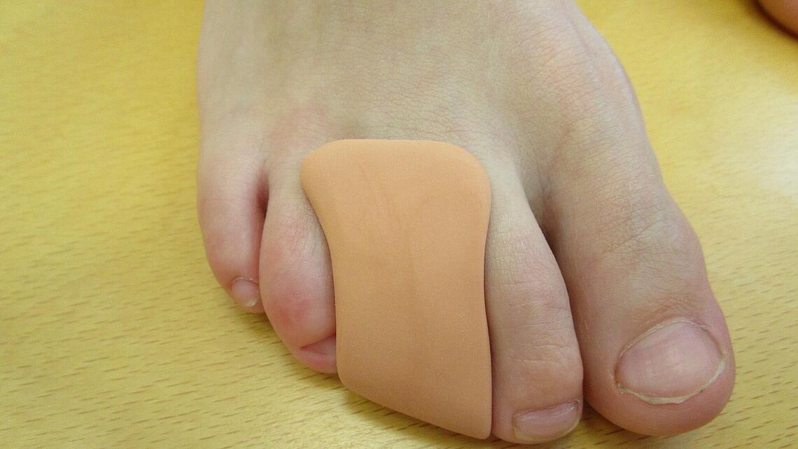 Orthese zur Überbrückung eines fehlenden Zehs