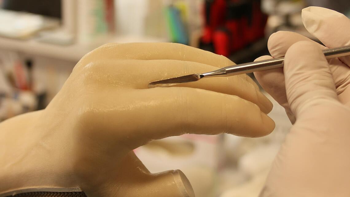 Formung der Finger einer Unterarmprothese mit Spatel
